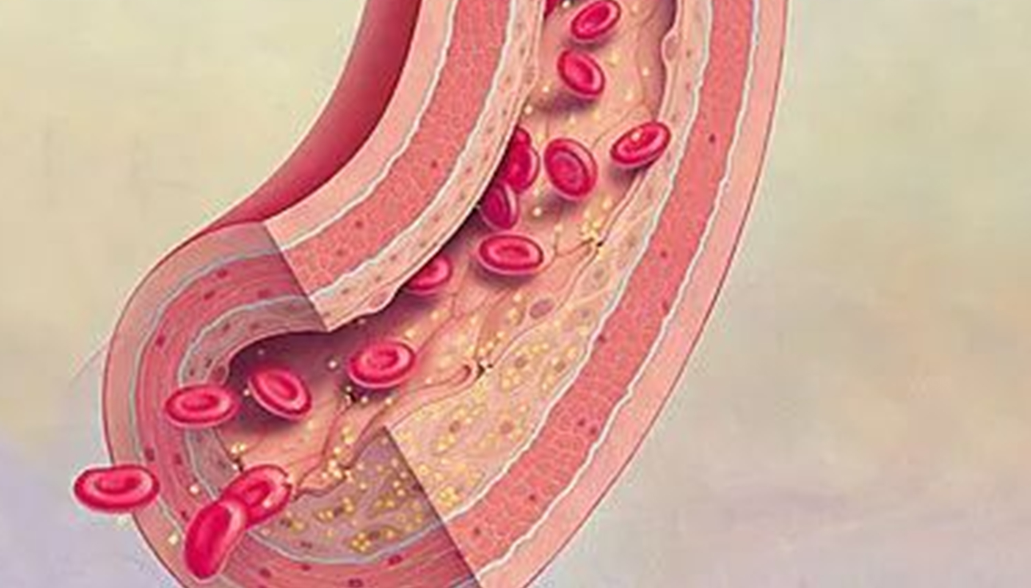血栓形成，三個要素細分說