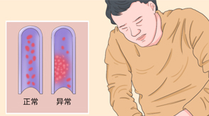 VTE的危害您了解嗎？