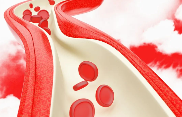 血栓危害大，預(yù)防有辦法