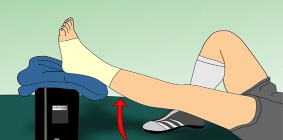 深靜脈血栓的健康宣教 深靜脈血栓的健康宣教