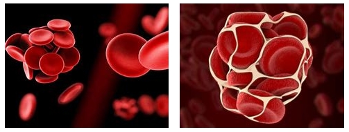 妊娠過程中的“潛伏殺手”——易栓癥 妊娠過程中的“潛伏殺手”——易栓癥