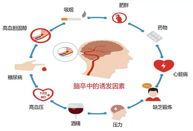 腦梗與深靜脈血栓：不可忽視的血管危機(jī)
